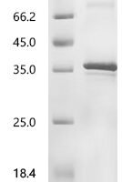(Tris-Glycine gel) Discontinuous SDS-PAGE (reduced) with 5% enrichment gel and 15% separation gel.