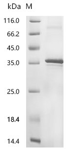 Recombinant Human 2-acylglycerol O-acyltransferase 2 (MOGAT2) Protein, Homo sapiens (Human), in vitro E.coli expression system, N-terminal 6xHis-tagged, 39.2kDa, purity >85% as determined by SDS-PAGE.