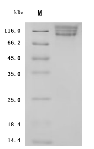 Recombinant Human ITGAV&ITGB6 Heterodimer Protein (Active)