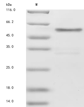 Recombinant Human Protein jagged-1 (JAG1), partial