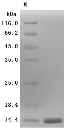 Recombinant Human Kidney-associated antigen 1 (KAAG1) (Active)