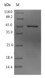 Recombinant Human Lysine-specific demethylase 3B (KDM3B), partial