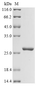 Recombinant Human Lysine-specific demethylase 6A (KDM6A), partial