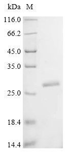 Recombinant Human Lysine-specific demethylase 6B (KDM6B), partial, Homo sapiens (Human), E.coli, C-terminal 6xHis-tagged, 23.9kDa, purity >90% as determined by SDS-PAGE.