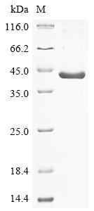 Recombinant Human Lysine-specific demethylase 6B (KDM6B), partial, Homo sapiens (Human), E.coli, N-terminal 6xHis-tagged, 41.5kDa, purity >85% as determined by SDS-PAGE.