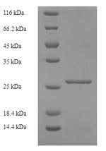Recombinant Human Killer cell immunoglobulin-like receptor 2DS1 (KIR2DS1), partial