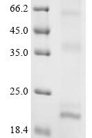 (Tris-Glycine gel) Discontinuous SDS-PAGE (reduced) with 5% enrichment gel and 15% separation gel.