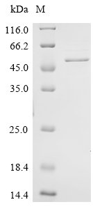 Recombinant Human Kelch domain-containing protein 3 (KLHDC3), Homo sapiens (Human), E.coli, C-terminal 6xHis-tagged, 50kDa, purity >90% as determined by SDS-PAGE.