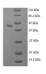 Recombinant Human Kallikrein-1 (KLK1)
