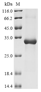 Recombinant Human Kallikrein-12 (KLK12)