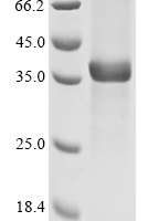 (Tris-Glycine gel) Discontinuous SDS-PAGE (reduced) with 5% enrichment gel and 15% separation gel.