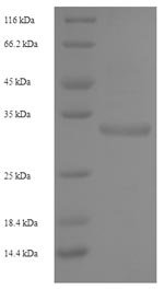 Recombinant Human NKG2-C type II integral membrane protein (KLRC2), partial, Homo sapiens (Human), E.coli, N-terminal 6xHis-SUMO-tagged, 31.8kDa, purity >90% as determined by SDS-PAGE.