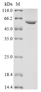 Recombinant Human Keratin, type I cytoskeletal 13 (KRT13), Homo sapiens (Human), E.coli, N-terminal 10xHis-tagged and C-terminal Myc-tagged, 57.0kDa, purity >90% as determined by SDS-PAGE.