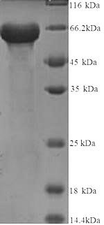 Recombinant Human KeRatin, type I cytoskeletal 14 (KRT14)