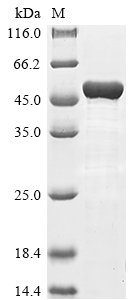 Recombinant Human Keratin, type I cytoskeletal 18 (KRT18), Homo sapiens (Human), E.coli, N-terminal 6xHis-tagged, 52.0kDa, purity >85% as determined by SDS-PAGE.