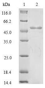 Recombinant Human KeRatin, type I cytoskeletal 18 (KRT18), partial