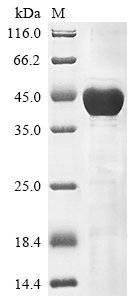 Recombinant Human Keratin, type I cytoskeletal 18 (KRT18)