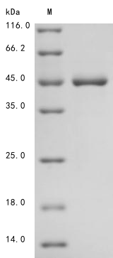 Recombinant Human Keratin, type I cytoskeletal 19 (KRT19)