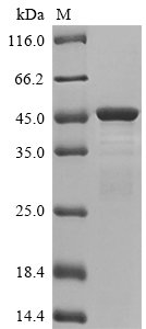 Recombinant Human Keratin, type I cytoskeletal 19 (KRT19), Homo sapiens (Human), E.coli, N-terminal 6xHis-tagged, 48.2kDa, purity >85% as determined by SDS-PAGE.