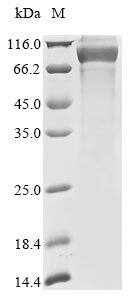 Recombinant Human Keratin, type I cuticular Ha4 (KRT34)