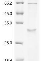 (Tris-Glycine gel) Discontinuous SDS-PAGE (reduced) with 5% enrichment gel and 15% separation gel.