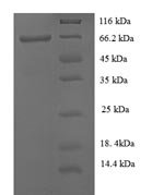 Recombinant Human Keratin, type I cuticular Ha8 (KRT38)