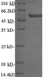 Recombinant Human Keratin, type II cytoskeletal 4 (KRT4), Homo sapiens (Human), E.coli, N-terminal 6xHis-SUMO-tagged, 73.3kDa, purity >90% as determined by SDS-PAGE.