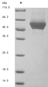 Recombinant Human Keratin, type II cytoskeletal 8 (KRT8)