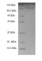 Recombinant Human Keratin,type II cytoskeletal 8 (KRT8), partial, Homo sapiens (Human), E.coli, N-terminal 6xHis-SUMO-tagged, 66.5kDa, purity >90% as determined by SDS-PAGE.