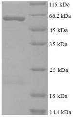 Recombinant Human Kynurenine--oxoglutarate transaminase 1 (KYAT1)