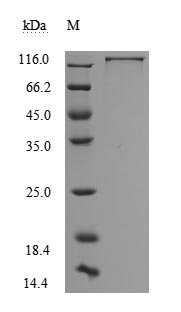 Recombinant Human Neural cell adhesion molecule L1 (L1CAM), partial (Active)