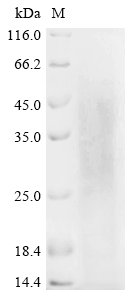 Recombinant Human L-lactate dehydrogenase A chain (LDHA), Homo sapiens (Human), Yeast, N-terminal 6xHis-tagged, 38.6kDa, purity >85% as determined by SDS-PAGE.