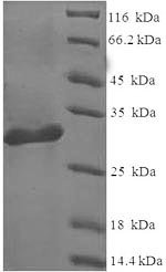 Recombinant Human Galectin-1 (LGALS1), Homo sapiens (Human), E.coli, N-terminal 6xHis-SUMO-tagged, 30.6kDa, purity >90% as determined by SDS-PAGE.