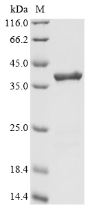 Recombinant Human Lon protease homolog, mitochondrial (LONP1), partial, Homo sapiens (Human), E.coli, N-terminal 10xHis-tagged and C-terminal Myc-tagged, 35.6kDa, purity >90% as determined by SDS-PAGE.