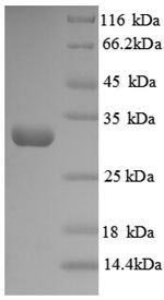 Recombinant Human Protein-lysine 6-oxidase (LOX), partial, Homo sapiens (Human), E.coli, N-terminal 6xHis-tagged, 32.4kDa, purity >90% as determined by SDS-PAGE.