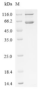 Recombinant Human Lysyl oxidase homolog 1 (LOXL1), Homo sapiens (Human), E.coli, C-terminal 6xHis-tagged, 59.9kDa, purity >85% as determined by SDS-PAGE.