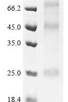 (Tris-Glycine gel) Discontinuous SDS-PAGE (reduced) with 5% enrichment gel and 15% separation gel.