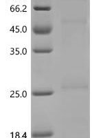 (Tris-Glycine gel) Discontinuous SDS-PAGE (reduced) with 5% enrichment gel and 15% separation gel.