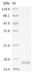 Recombinant Human Lymphocyte antigen 6E (LY6E), Homo sapiens (Human), E.coli, C-terminal 6xHis-tagged, 15.4kDa, purity >90% as determined by SDS-PAGE.