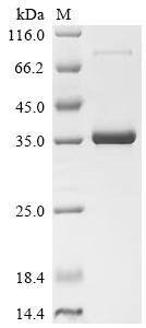 Recombinant Human Lymphocyte antigen 6E (LY6E) (Active), Homo sapiens (Human), Mammalian cell, N-terminal hFc-tagged, 34.6kDa, purity >95% as determined by SDS-PAGE.