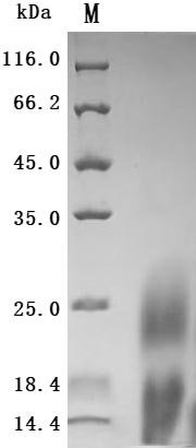 Recombinant Human Lymphocyte antigen 6 complex locus protein G6d (LY6G6D) (Active)
