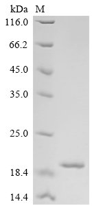 Recombinant Human Lymphocyte antigen 6K (LY6K), Homo sapiens (Human), E.coli, N-terminal 10xHis-tagged and C-terminal Myc-tagged, 19.2kDa, purity >90% as determined by SDS-PAGE.