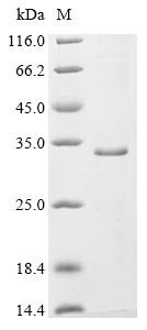 Recombinant Rat Synaptogyrin-1 (Syngr1) Protein, Rattus norvegicus (Rat), in vitro E.coli expression system, N-terminal 10xHis-tagged, 31.7kDa, purity >85% as determined by SDS-PAGE.