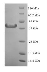 Recombinant Human Mitotic spindle assembly checkpoint protein MAD2A (MAD2L1), Homo sapiens (Human), E.coli, N-terminal 6xHis-SUMO-tagged, 39.4kDa, purity >90% as determined by SDS-PAGE.