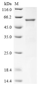 Recombinant Human Myelin-associated glycoprotein (MAG), partial
