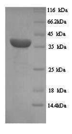 Recombinant Human Melanoma-associated antigen 1 (MAGEA1), Homo sapiens (Human), Yeast, N-terminal 6xHis-tagged, 36.3kDa, purity >90% as determined by SDS-PAGE.