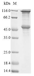 Recombinant Human Melanoma-associated antigen 2 (MAGEA2)