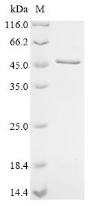 Recombinant Human Melanoma-associated antigen 3 (MAGEA3), Homo sapiens (Human), E.coli, N-terminal 10xHis-tagged, 40.8kDa, purity >85% as determined by SDS-PAGE.