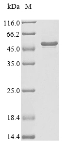 Recombinant Human Melanoma-associated antigen 6 (MAGEA6), Homo sapiens (Human), E.coli, N-terminal 10xHis-tagged and C-terminal Myc-tagged, 42.3kDa, purity >85% as determined by SDS-PAGE.