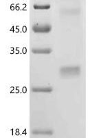 (Tris-Glycine gel) Discontinuous SDS-PAGE (reduced) with 5% enrichment gel and 15% separation gel.